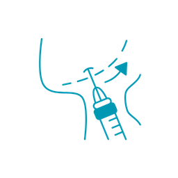 Jawline (Çene Dolgusu)